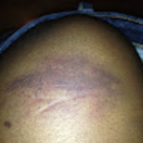 Meet your Posher, Ashante - Picture 1 of 1